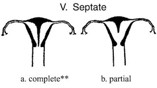 https://blogger.googleusercontent.com/img/b/R29vZ2xl/AVvXsEiAIAgMFA48r0MRVUCl4hpG3EPd3sAmJ4YJYWr_c5-XWEAICsWrCiWSeQvgMetJlHyn-ov8JAA43KMu-Pweja0gEYZyoKu12Z6FPgHSqnB3lDItieacb6nDRRVy0y_moYkJUubQ/s400/uterine-septate.jpg