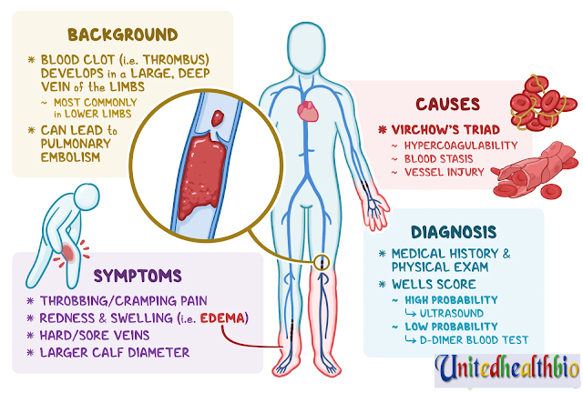 Deep Vein Thrombosis-What is it, Causes, Prevention, and More1