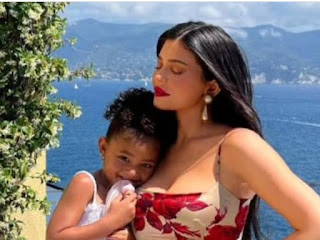 Kylie Jenner's Candid Confessions: Plastic Surgery and the Heartfelt Motherly Concerns