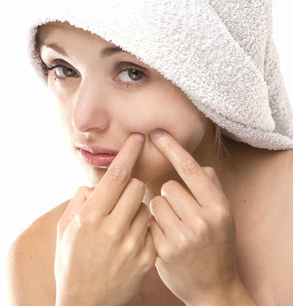 Remedy to Eliminate Acne Pimple