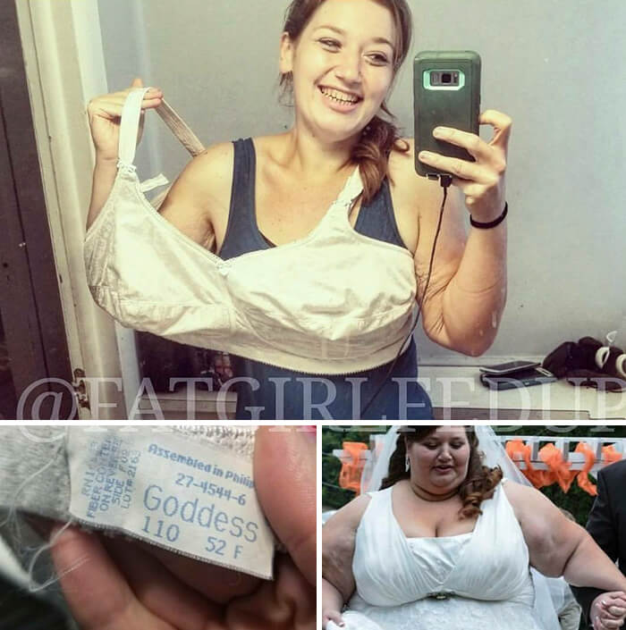 Incredible Before And After Pictures Of A Woman Who Used To Weigh 485lbs