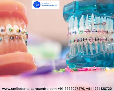 Orthodontic Dental Clinic in India