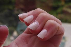 http://crackednail-polish.blogspot.com/2013/07/how-do-i-treat-fungal-nail-infection-on.html