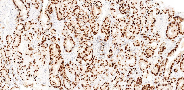 Immunohistochemistry (IHC)