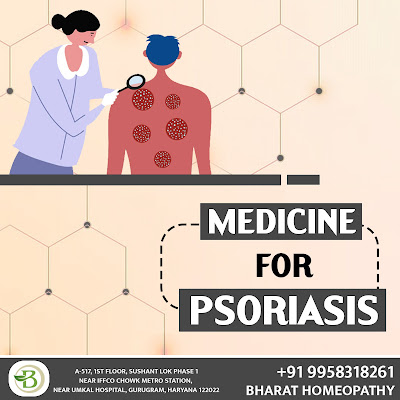 Psoriasis treatment by homeopathy