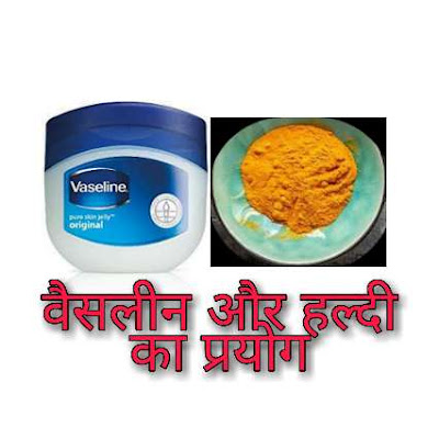 vaseline aur haldi se anchahe baal hataye