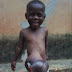SEE WHAT HAPPENED TO A BOY WITH AN EXTERNAL ORGAN GROWING UNDER HIS ABDOMEN DISCOVERED..CONT