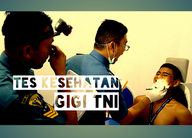 Tips 100% Lolos Tes Kesehatan Gigi TNI Terbaru