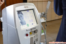 Accent Prime For Facial & Body Contouring Treatment