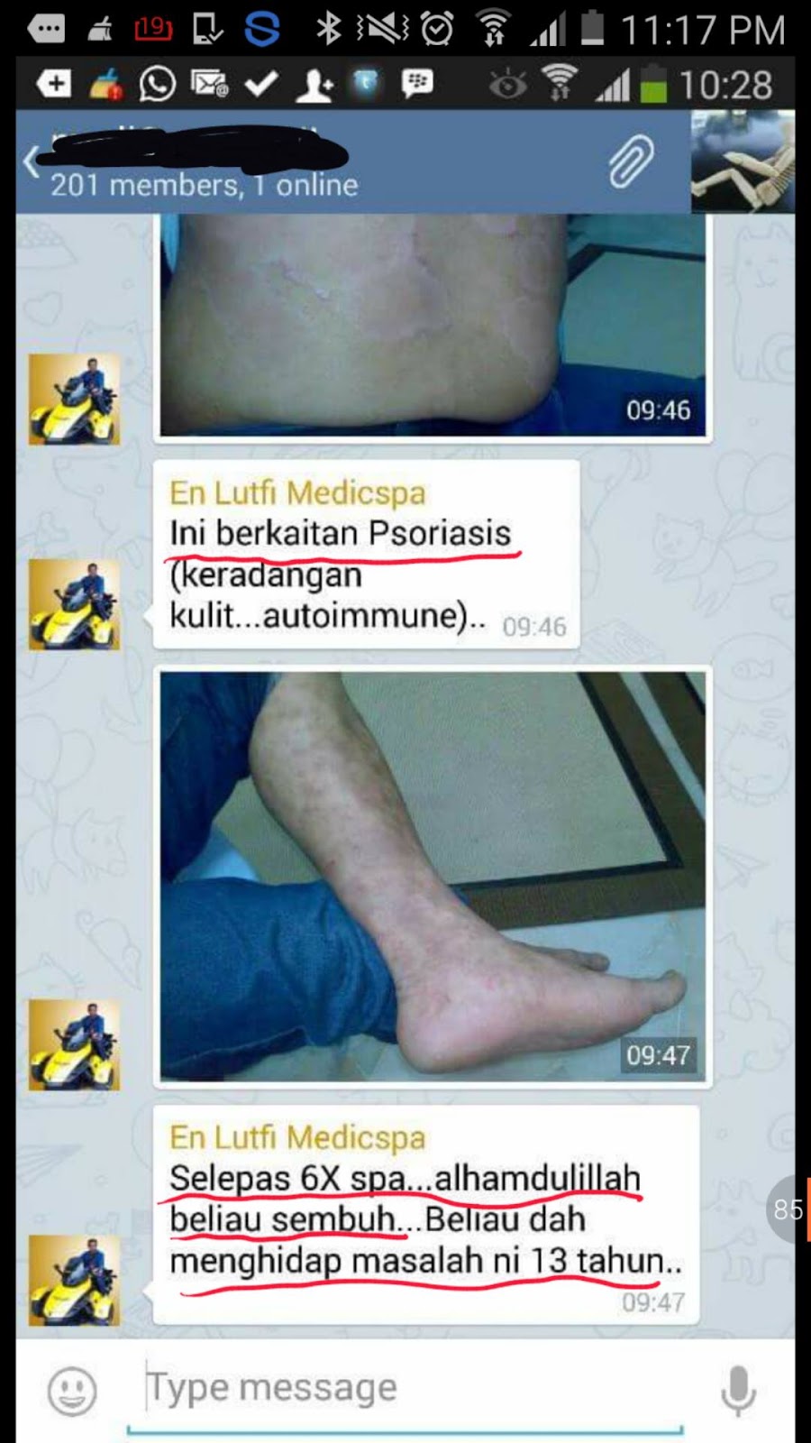 Pusat Rawatan Sakit Eczema: MEDICSPA MERAWAT SAKIT ECZEMA 