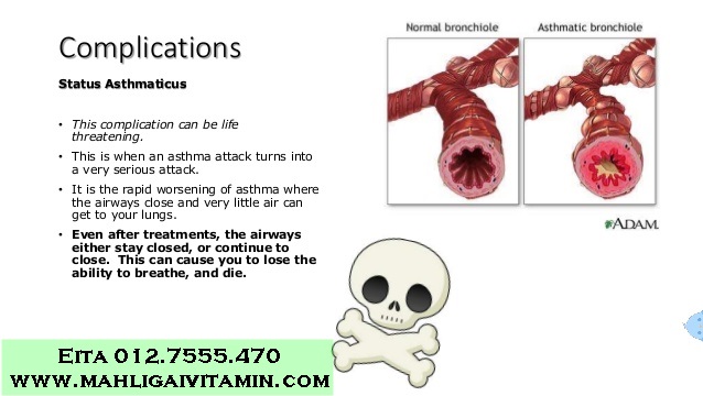 Apakah Ubat Penyakit Asthma @ Semput @ Lelah Selain 