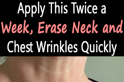 Apply This Twice a Week, Erase Neck and Chest Wrinkles Quickly