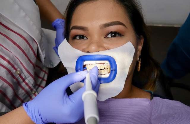 My Teeth Whitening Experience + Dos and Donts brightsmile avenue dental bgc morena filipina beauty blog