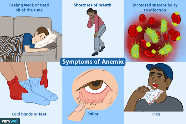 Anemia causes and methods of prevention | healthy care