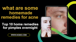 what are some homemade remedies for acne - Top 10 home remedies for pimples overnight