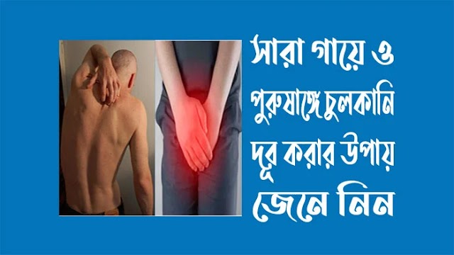 পুরুষাঙ্গের চুলকানি দূর করার জন্য কার্যকরী ক্রিম