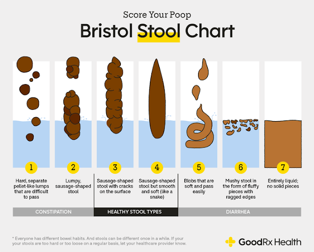What Your Stool's  Says About Your Health