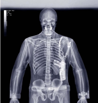 xray pictures