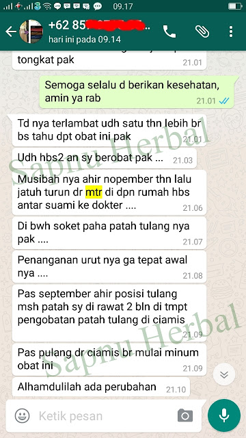 Obat Patah Tulang Tangan ( Lengan ) Tradisional Yang Ampuh