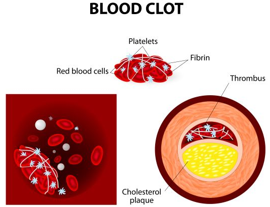 Home Aayurvedic Remedies to Cure Blood Disorder