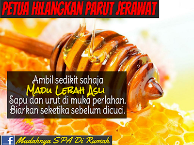 petua hilangkan parut jerawat