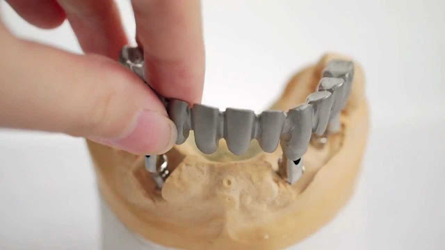 Top 5 Dental Implants Products You Should Know About