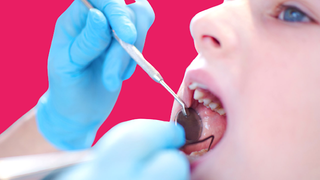 Why Does Tooth Decay Occur?