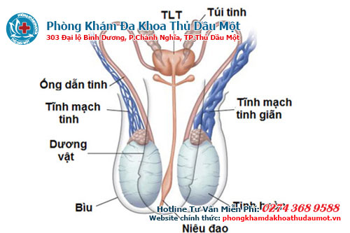 Điều trị bệnh giãn tĩnh mạch thừng tinh