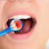 Điều trị nướu răng bị sưng đau như thế nào?