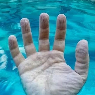 لماذا تتجعد الأصابع بعد الاستحمام أو السباحة لفترة طويلة؟ 