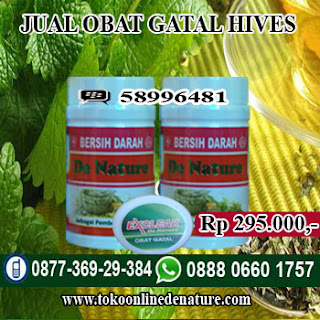 JUAL OBAT GATAL HIVES