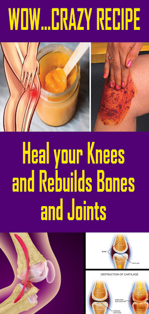 WOW... CRAZY RECIPE TO HEAL YOUR KNEES AND REBUILDS BONES AND JOINTS
