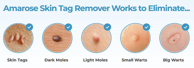 Amarose Skin Tag Remover Benefits