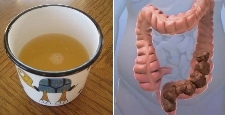 Here Is A Powerful Home Remedy To Cleanse Your Colon Naturally