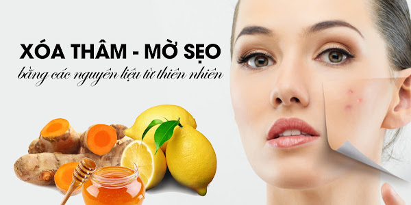 Bí quyết trị sẹo thâm làm đẹp da mặt đơn giản mà hiệu quả