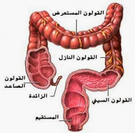 أعراض مرض سرطان القولون Symptoms of colon cancer