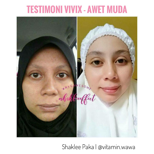 Set cantik shaklee, Set Cantik Bajet Shaklee, Set Cantik Premium Shaklee Harga set cantik shaklee Keistimewaan set cantik shaklee Cara makan set cantik shaklee ESP SHAKLEE, testimoni set cantik shaklee bebas jerawat, bebas parut, testimoni set cantik shaklee, testimoni set cantik premium  shaklee, testimoni set cantik shaklee - resv dan vivix, testimoni resv shaklee, testimoni vivix shaklee, testimoni resv shaklee untuk cantik, testimoni vivix shaklee untuk kulit cantik, testimoni set cantik shaklee,set cantik bajet shaklee  testimoni set cantik shaklee  set cantik shaklee new packaging  harga set cantik shaklee  set kulit cantik shaklee bajet  youth shaklee  set kurus shaklee  cara makan set kecantikan shaklee