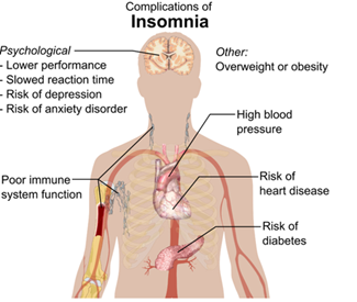 Cara mengatasi insomnia