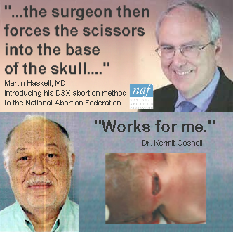 The surgeon then forces the scissors into the base of the skull.