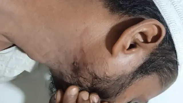 বেগমগঞ্জে শিক্ষক দম্পত্তিকে পিটিয়ে জখম