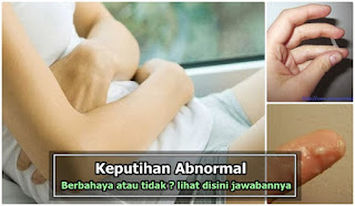 7 NAMA OBAT KEPUTIHAN AMPUH DAN MURAH DI APOTIK