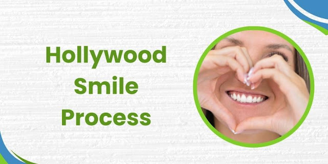 Hollywood Smile Process