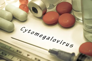 Citomegalovirus,embarazo
