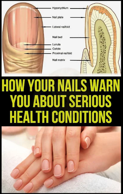 How Your Nails Warn You About Serious Health Conditions