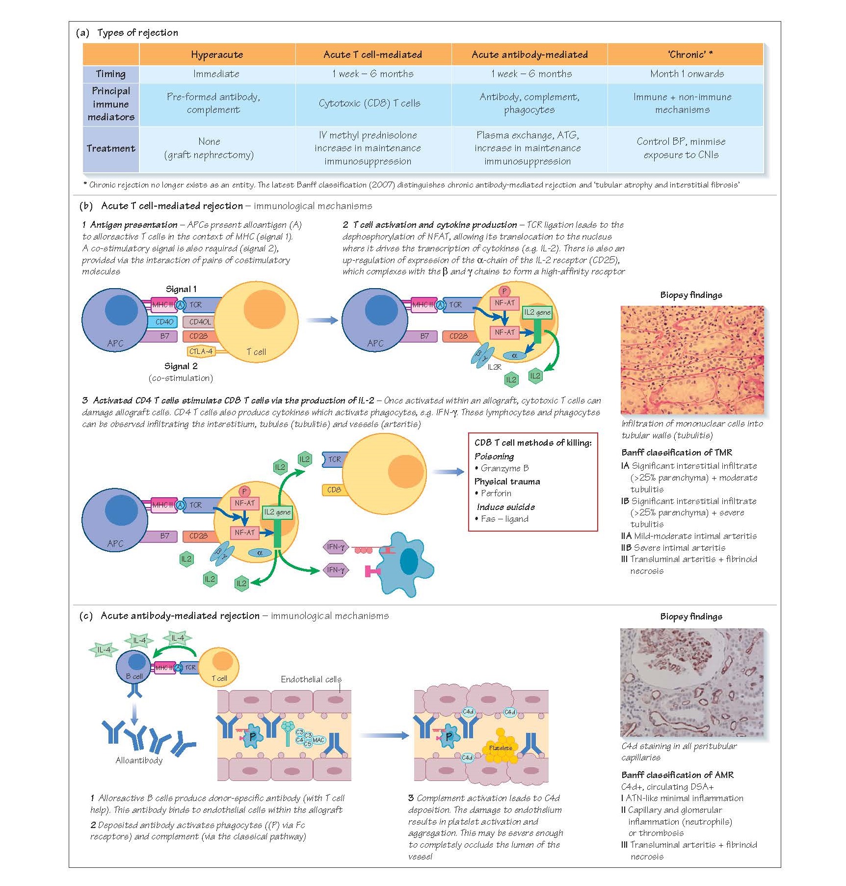 Transplant Rejection, Hyperacute rejection, Acute cellular rejection, Immunological mechanisms, Biopsy f﻿indings, Acute antibody-mediated rejection,