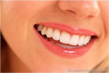 Sorriso1 (Small)