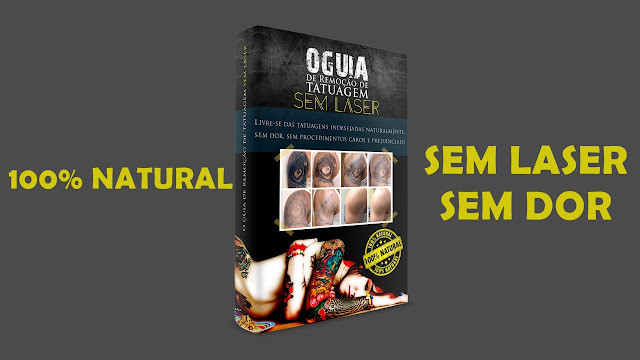 quero-remover-tatuagem-agora