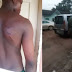 Nigerian Army Apologizes To CDSS Student Brutalized Over Incomplete Uniform