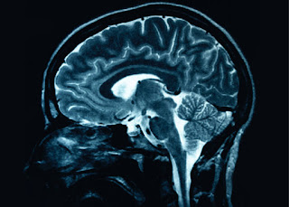 Inflammatory Disease Affects Brain Activity