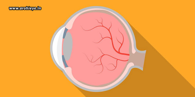 Retina Treatment in Andheri West